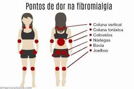 Fibromialgia: como conviver com uma dor que não passa?