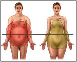 Obesidade sobrecarrega a coluna e pode causar hérnia de disco